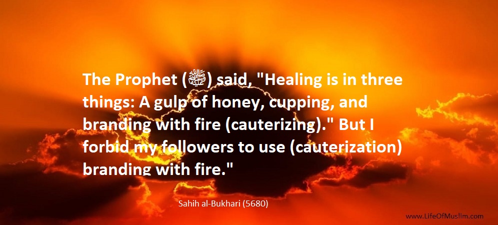 Healing Is in Three Things, A Gulp Of Honey, Cupping And Cauterizing